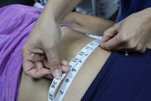 customer being measured before cyroskin treatment